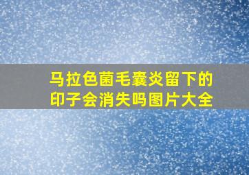 马拉色菌毛囊炎留下的印子会消失吗图片大全